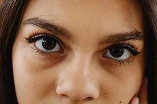 Close-up of a woman's eyes, showing the upper lids and the skin beneath the eyes