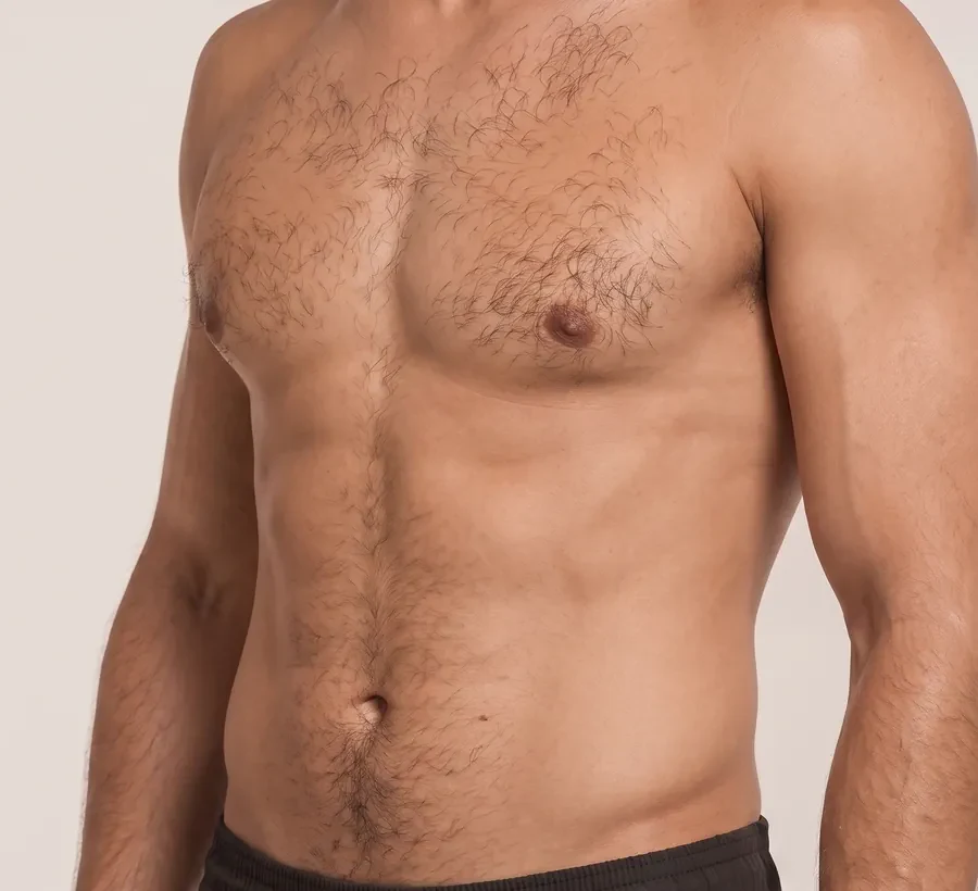 Gynecomastia surgery at ESJ Aesthetics